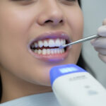 promo bleaching gigi Dela Dental Care