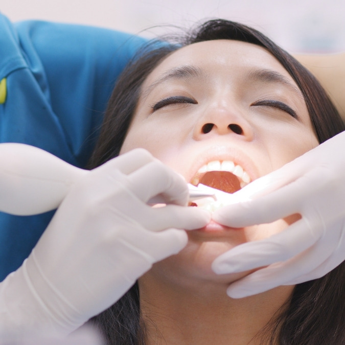Diskon cabut gigi dela dental care sidoarjo
